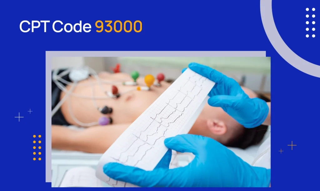 CPT Code 93000: Description & Reimbursement Guidelines