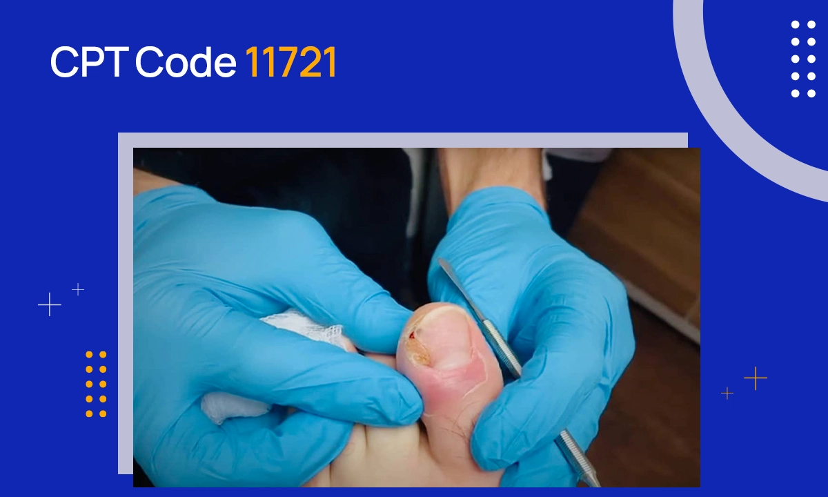 CPT Code 11721