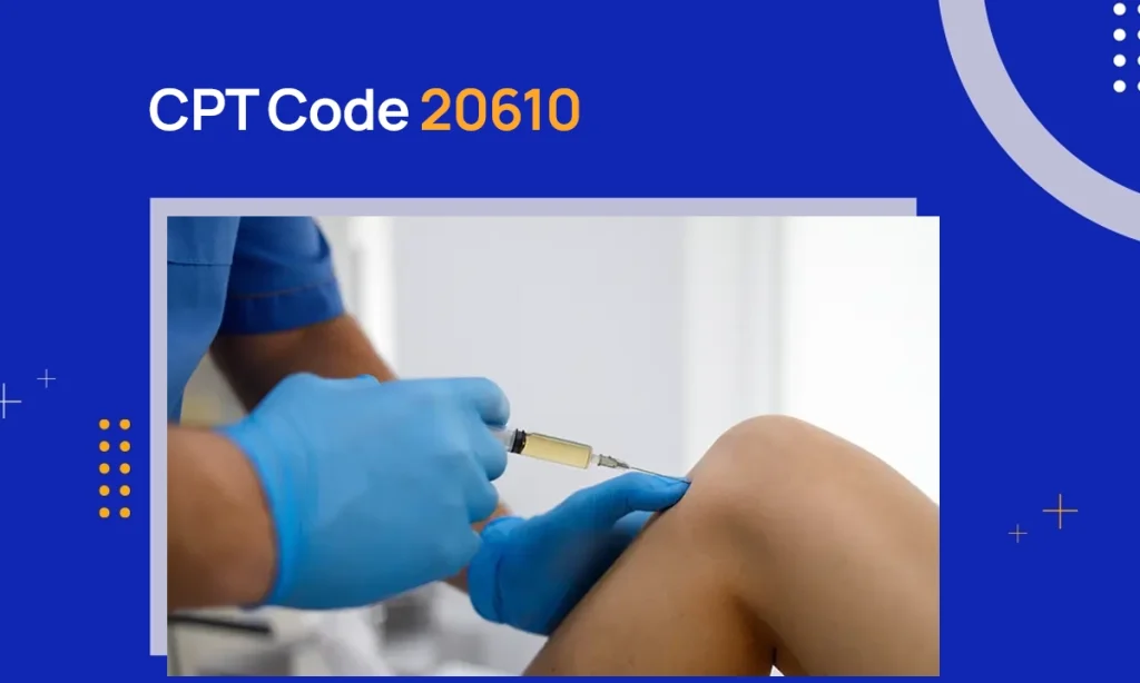 CPT Code 20610: Description & Reimbursement Guidelines