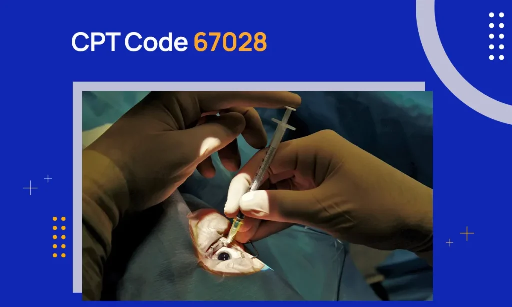 CPT Code 67028: Description & Reimbursement Guidelines