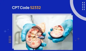 CPT Code 52332
