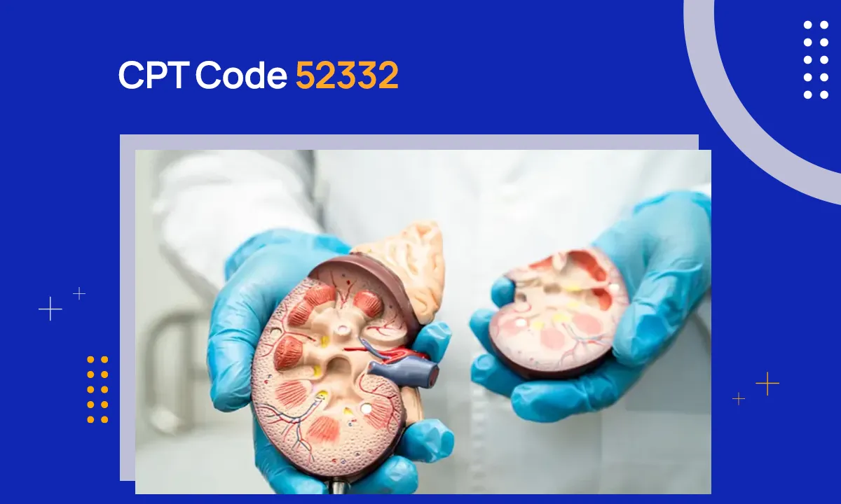 CPT Code 52332