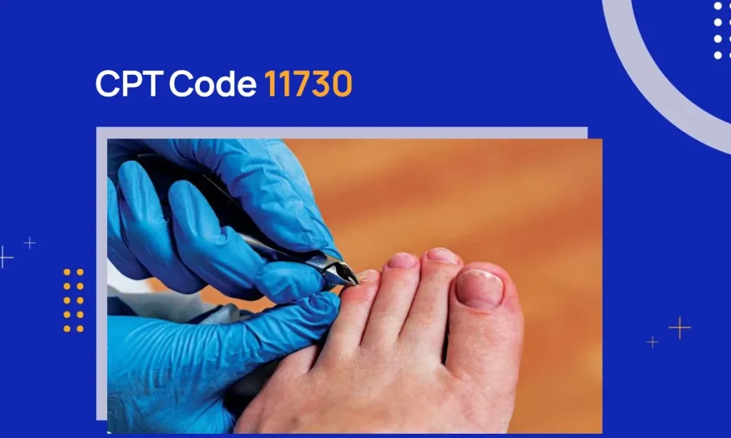 CPT Code 11730